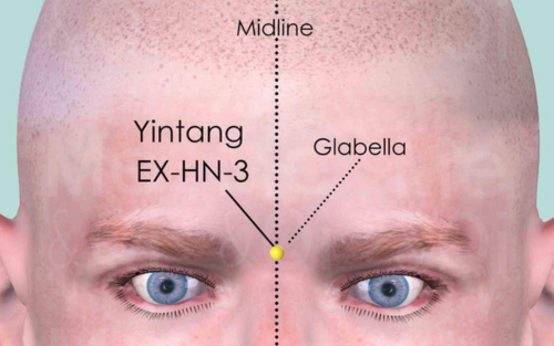 Yintang  | Het punt van verstilling